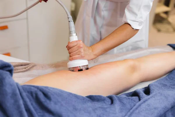 Radiofrequency Ablation